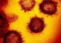 Jumlahnya Bertambah Makin Banyak dalam Kurun Waktu Satu Minggu, Berikut Daftar 19 Pasien Positif Virus Corona di Indonesia