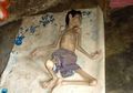 Malangnya Supriadi, Tubuh Pria 24 Tahun Ini Kurus Kering dan Tak Bisa Jalan, Berawal dari Gangguan Pencernaan dan Demam Tinggi Saat Kecil