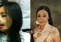 Disiram Air Keras oleh Suaminya Sendiri, Wanita Ini Harus Kehilangan Seluruh Wajah Cantiknya, 7 Tahun Hidup di Rumah Sakit, Dokter Masih Belum Mampu Kembalikan Wajahnya Seperti Semula