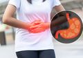 Apakah Penyakit GERD Bisa Disembuhkan? Begini Jawaban Dokter