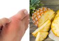 Tak Perlu Berobat Kemana-mana, Rutin Minum Campuran Nanas dan Madu Terbukti Ampuh Mengatasi Asam Urat