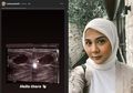 Baru Tunangan, Hasil USG Kesha Ratuliu Tersebar hingga Buat Geger Warganet, 'Kok Hamil di Luar Nikah?'