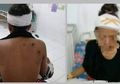 Minta Diantarkan ke Desa Sebelah, Wanita Ini Justru Digigit Dada dan Punggungnya Hingga Nyaris Tewas oleh Tetangga, Alasannya Bikin Gemas Kaum Hawa