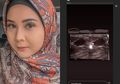 Disangka Hamil di Luar Nikah Saat Posting USG, Kesha Ratuliu Buka Suara: Sedih Aku tuh