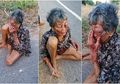 Nenek Renta Ditemukan dalam Kondisi Memilukan Terduduk di Pinggir Jalan, Kabur dari Rumah dengan Tubuh Babak Belur