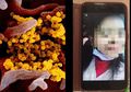 Kelewat Santuy, WNI yang Positif Terinfeksi Corona di Taiwan Nampak Sama Sekali Tak Cemas, Sempat-sempatnya Main TikTok dan Live Streaming Facebook