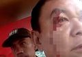 TNI dan Polri Terlibat Bentrok Hanya Gara-gara Masalah Sepele, Seorang Warga Sipil Jadi Korban, Ini yang Terjadi Setelah Mediasi