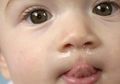 Akibat Anak Hidungnya Tersumbat, Orangtua Sedot Ingus , Bisa Merusak Rongga Hidung!