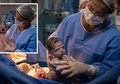 Viral Potret Seorang Bayi Tunjukkan Ekspresi Marah Sesaat Setelah Dilahirkan, Dokter pun Segera Mencoba Membuatnya Menangis, Ini Alasannya