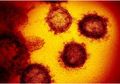 Sering Dianggap Sama, Ternyata Ini Perbedaan antara Virus dan Bakteri