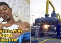 Lagi-lagi China Disebut Biang Keladinya, Muncul Penyakit Misterius di Afrika, Pasien Alami Telapak Tangan dan Mata Menguning, Pendarahan Lalu Mati, Sudah Ada 2.000 Orang Mati
