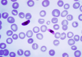 Peneliti Temukan Obat Malaria yang Lebih Efektif Menyembuhkan Penyakit