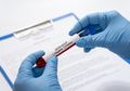 Tak Hanya Cuci Tangan, Konsumsi 2 Hal Ini Setiap Hari Ampuh Jaga Daya Tahan Tubuh dan Tangkal Virus Corona, Begini Penjelasan Ahli Virus