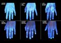 Cuci tangan Dengan Sabun Vs Hand Sanitizer, Hanya Kuman yang Dibasmi Hingga Iritasi