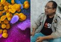 Tetap Tenang dan Jangan Panik, Seorang Ahli Asal Indonesia Sembuh Total Melawan Virus Corona: Covid-19 Itu Tidak Berbahaya!