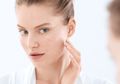 Aneka Trik Menutupi Bekas Jerawat Menggunakan Makeup karena #SemuaBisaCantik