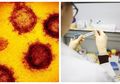 Selama Ini Tak Pernah Diungkapkan, Ilmuwan Bocorkan Ada Tes Khusus yang Bisa Menunjukkan Seseorang Kebal Terhadap Virus Corona
