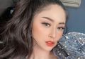 Unggah Foto Kulit Wajah Merah-merah Dewi Perssik Sempat Bikin Netizen Khawatir, Ini Jawabannya!