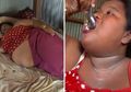 Desa Ini Jadikan Cewek Obesitas sebagai Primadona, Badan Kurus Dianggap Nggak Menarik