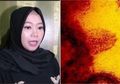 Bak Efek Domino, Pelaku Spiritual Kondang Ini Beberkan Ada Lebih dari 5 Nama Artis yang Jadi Korban Tertular Wabah Corona, Siapa?