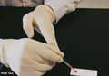 Alat Tes Cepat Produk China yang Dibeli Spanyol Gagal Deteksi Positif Virus Corona