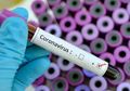 Kabar Baik! Terungkap Cara Tangkal Covid-19 Agar Virus Corona di Indonesia Segera Berakhir