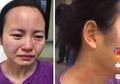 Tolak Diambil Darahnya, Pasien Covid-19 di China Gigit Perawat hingga Berdarah