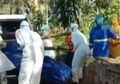 Peneliti Kembali Lakukan Investigasi, Keganasan Virus Corona Terlacak Tak Hanya Rusak Paru-paru Saja, Otak Manusia Bahkan Jadi Korbannya