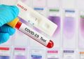 Berbagai Metode Test Covid-19; PCR, Rapid Test, TCM, Apa Perbedaannya?