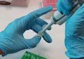 Prototype Test Kit Covid-19 Buatan Indonesia Kelar, Siap Diproduksi