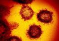 Bisa Sampai Rusak Organ Vital Pria Tanpa Masuki Sel di Dalam Organ, Inilah Bahaya Virus Corona yang Belum Diketahui Banyak Pria, Hati-hati Bisa Sebabkan Kemandulan!