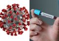 Makin Sulit Disembuhkan! Peneliti China Kabarkan Temuan Mutasi Baru Virus Corona yang Lebih Ganas, Bisa Menginfeksi Manusia Selama 49 Hari Tanpa Gejala