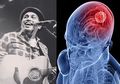 Penjelasan Penyakit Meningitis yang Menyebabkan Glenn Fredly Meninggal, 3 Makanan Ini Bisa Bantu Tangkal Bahayanya!