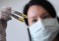 Menurunnya Daya Kebal Mengakibatkan Infeksi Covid-19 Kedua Kali