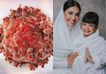Sering Dikaitkan dengan Penyakit Berbahaya para Artis, Ini Fakta yang Jarang Diketahui Mengenai Dry Cleaning
