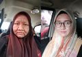Mengherankan, Wajah Wanita Cantik ini Berubah Menakutkan: Tebal, Bengkak dan Menghitam Saat ia Mengandung, Suami Sampai Tidak Bisa Kenali