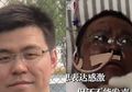 Jadi Bukti Kejamnya Covid-19, Terkuak Fakta Mengejutkan Terkait Kondisi Pasien Positif Corona di Kota Wuhan, Kulit Menggelap Seperti Terbakar