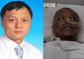 Bak Terbakar Api, 2 Dokter Ini Tersadar dengan Kondisi Kulit Hitam Lebam usai Masa Kritis Akibat Covid-19