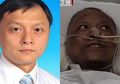 Menderita Covid-19, Seorang Pasien di China Alami Gejala Aneh Kulitnya Berubah Menjadi Hitam Pekat, Dokter Ungkap Penyebabnya