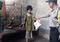 Viral Warga Muara Enim Ditemukan Kelaparan, di Indonesia Masih Ada Kwashiorkor?