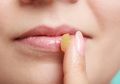 Selama Puasa Bibir Enggak Kering dan Pecah-pecah? Coba Rutin Pakai Lip Serum, Yuk!