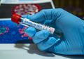 Bio Farma Produksi PCR 100.000 Unit, Didanai Penggalangan Dana Gerakan Gasti Bisa
