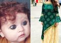 Dijuluki 'Monster' Saat Kecil Gara-gara Warna Kulit dan Matanya, Justru Setelah Dewasa Wanita Ini Jadi Primadona Kaum Lelaki