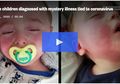 Picu 'Kekacauan' Detak Jantung, Gangguan Pernapasan Misterius Serang 85 Anak di Amerika, Kondisi Sistem Kekebalan Tubuh saat Melawan Covid-19 Diduga Jadi Pemicu