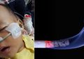 Sedih, Bayi Malang Ini Mengidap Penyakit Kronis karena Ayahnya Seorang Perokok Berat, Sang Ibu Curhat Pilu: Awalnya Saya Pikir, Ah Aman Aja tuh