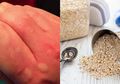 Obat Biduran Alami, Salah Satunya Tambahkan Oatmeal ke Air Mandi