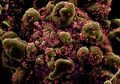 Akibat Virus Corona Sudah Mutasi Ribuan Kali, Ilmuwan Cemas Penemuan Vaksin Bakal Lama