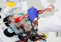 Diibaratkan 'Genset' saat Pandemi, Inilah Terapi Plasma Darah 'Pemangkas' Setengah Korban Flu Spanyol yang akan Mulai Diuji Coba dalam Skala Besar di Indonesia