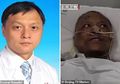 Kondisi Terkini dr Yi Fan, Kulit Menghitam Setelah Terinfeksi Virus Corona, Ternyata Penyebabnya Obat