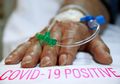 Ingin Buktikan Bahaya Covid-19 Tak Main-Main, Ilmuwan di China Autopsi Jenazah Pasien Corona dan Terkejut Melihat Organ Tubuh yang Rusak